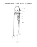 Device and Method for Crossing Occlusions diagram and image