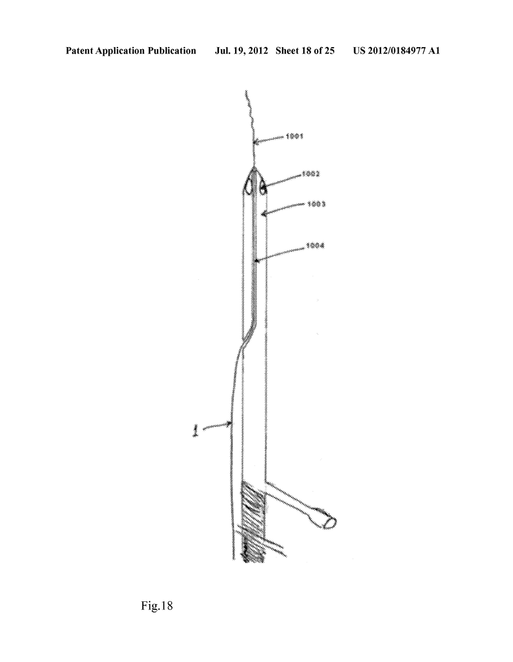 Device and Method for Crossing Occlusions - diagram, schematic, and image 19