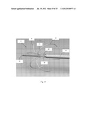 Device and Method for Crossing Occlusions diagram and image