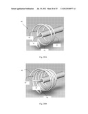 Device and Method for Crossing Occlusions diagram and image