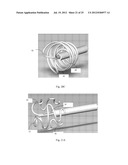 Device and Method for Crossing Occlusions diagram and image