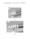 Device and Method for Crossing Occlusions diagram and image