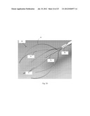 Device and Method for Crossing Occlusions diagram and image