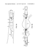 Methods and Systems for Treating Aneurysms diagram and image