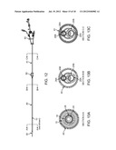 Methods and Systems for Treating Aneurysms diagram and image