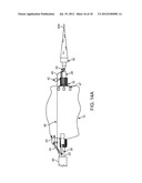 Methods and Systems for Treating Aneurysms diagram and image