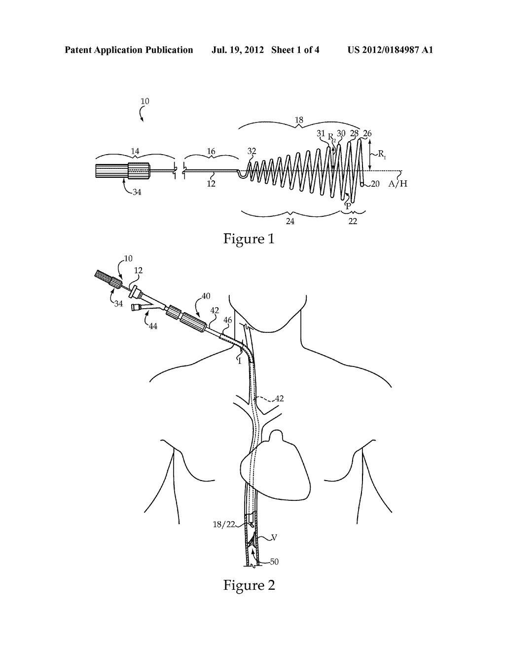 Vascular Implant Retrieval Method, Retrieval Assembly And Tool For Same - diagram, schematic, and image 02