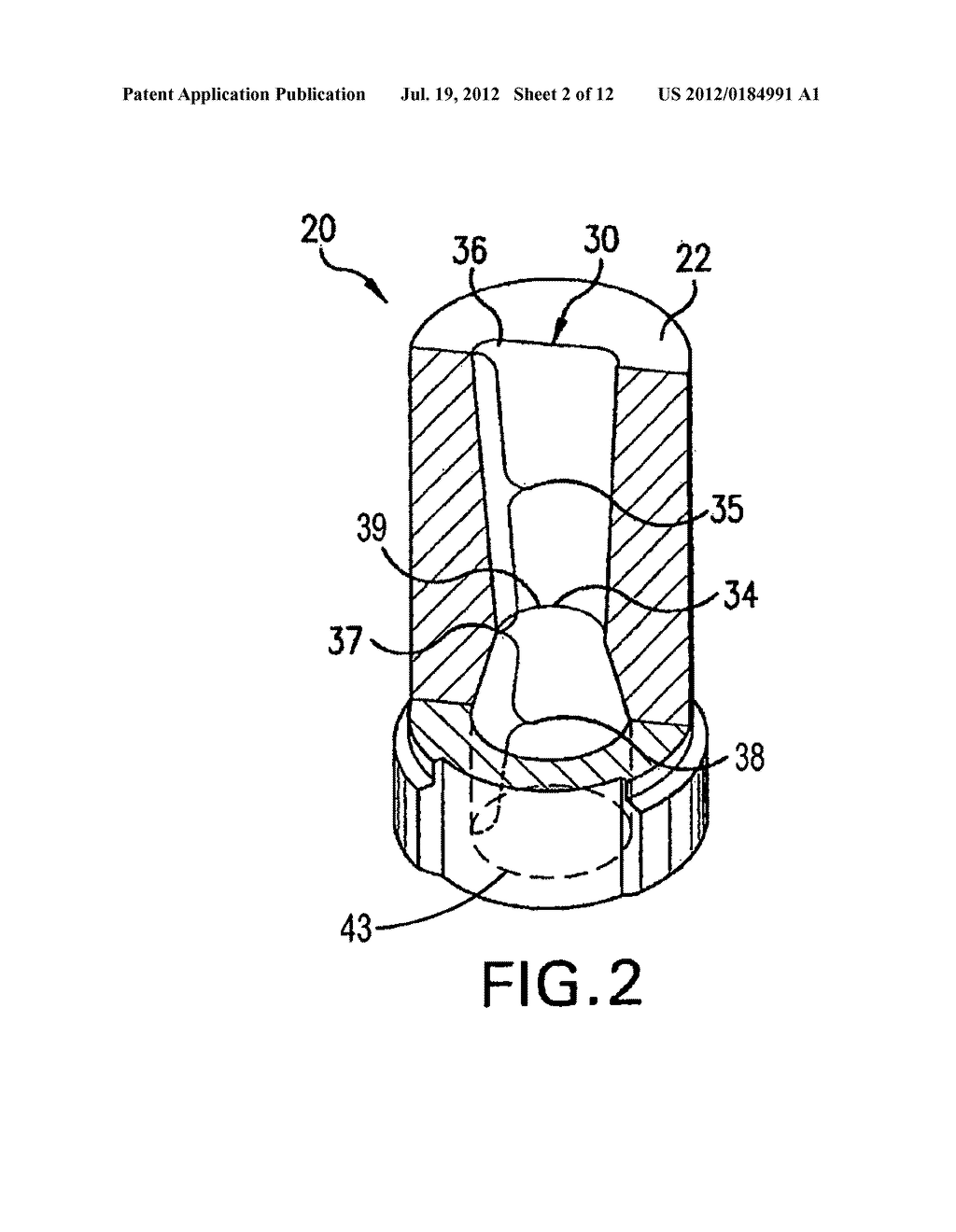 SUTURE LOCKING DEVICE AND METHODS - diagram, schematic, and image 03