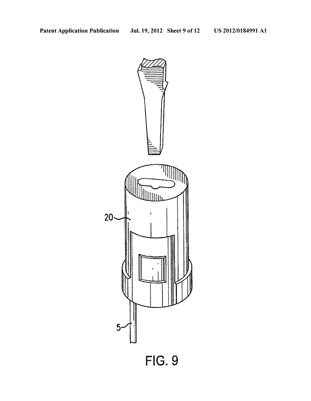 SUTURE LOCKING DEVICE AND METHODS - diagram, schematic, and image 10