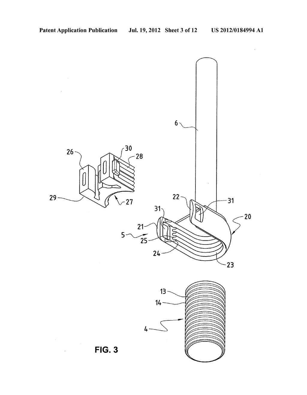 VERTEBRAL COLUMN IMPLANT - diagram, schematic, and image 04