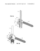 VERTEBRAL COLUMN IMPLANT diagram and image