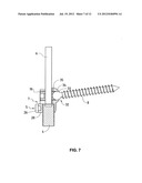 VERTEBRAL COLUMN IMPLANT diagram and image