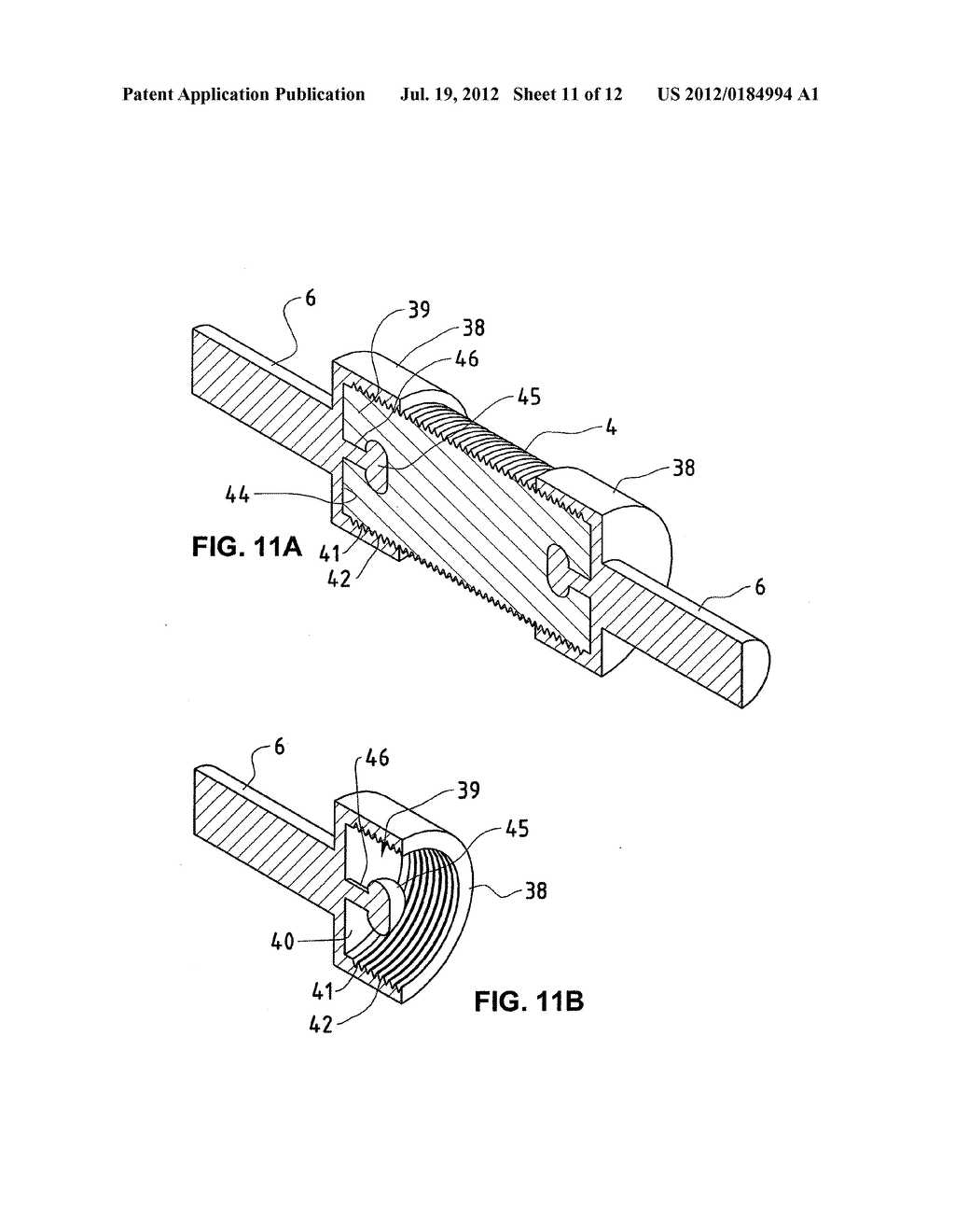 VERTEBRAL COLUMN IMPLANT - diagram, schematic, and image 12