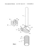 VERTEBRAL COLUMN IMPLANT diagram and image