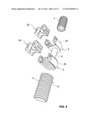 VERTEBRAL COLUMN IMPLANT diagram and image