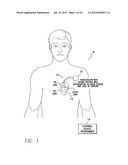 SYSTEMS AND METHODS FOR SELECTIVELY LIMITING MULTI-SITE VENTRICULAR PACING     DELAYS DURING OPTIMIZATION OF CARDIAC RESYNCHRONIZATION THERAPY     PARAMETERS diagram and image