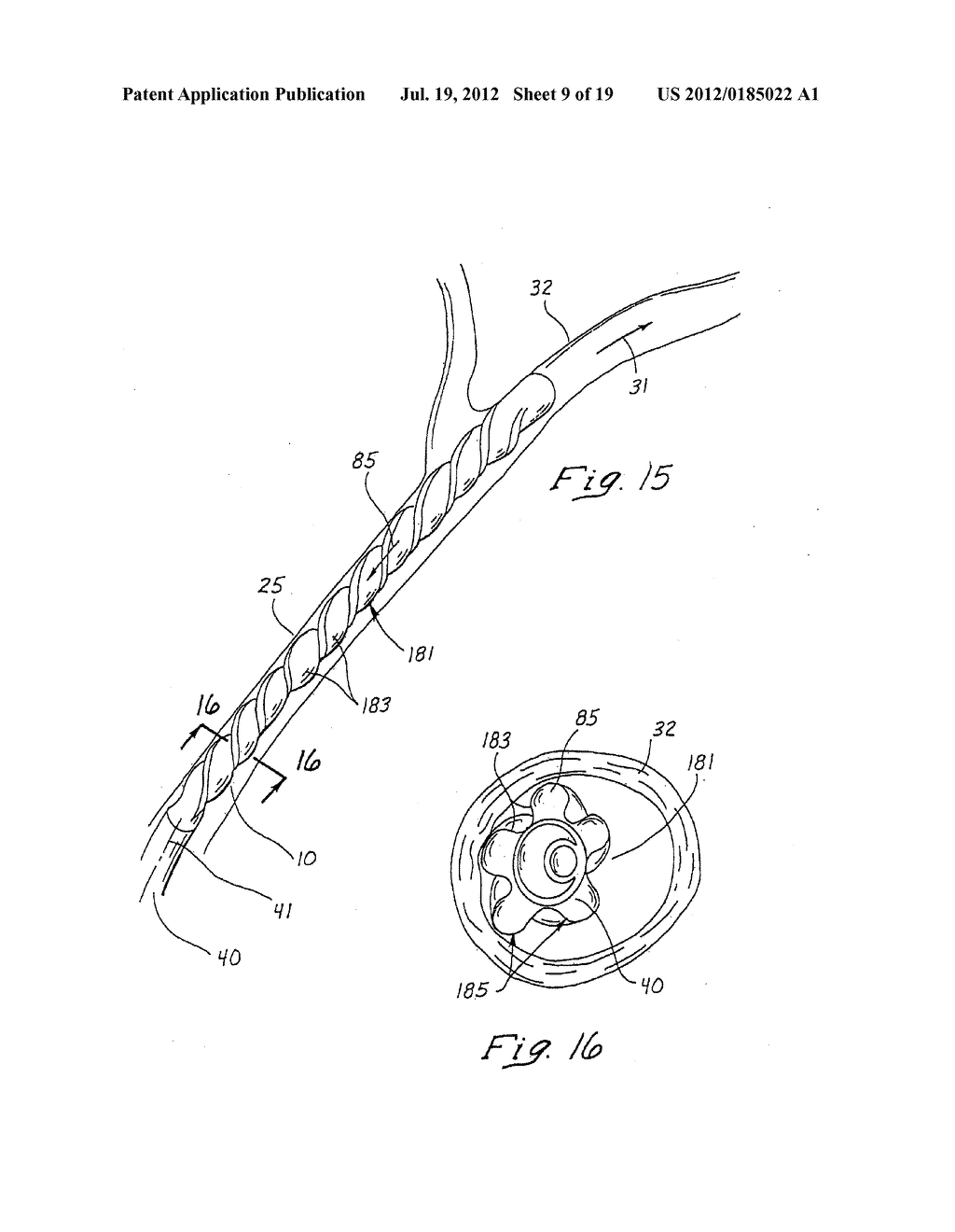 INDWELLING HEAT EXCHANGE CATHETER AND METHOD OF USING SAME - diagram, schematic, and image 10