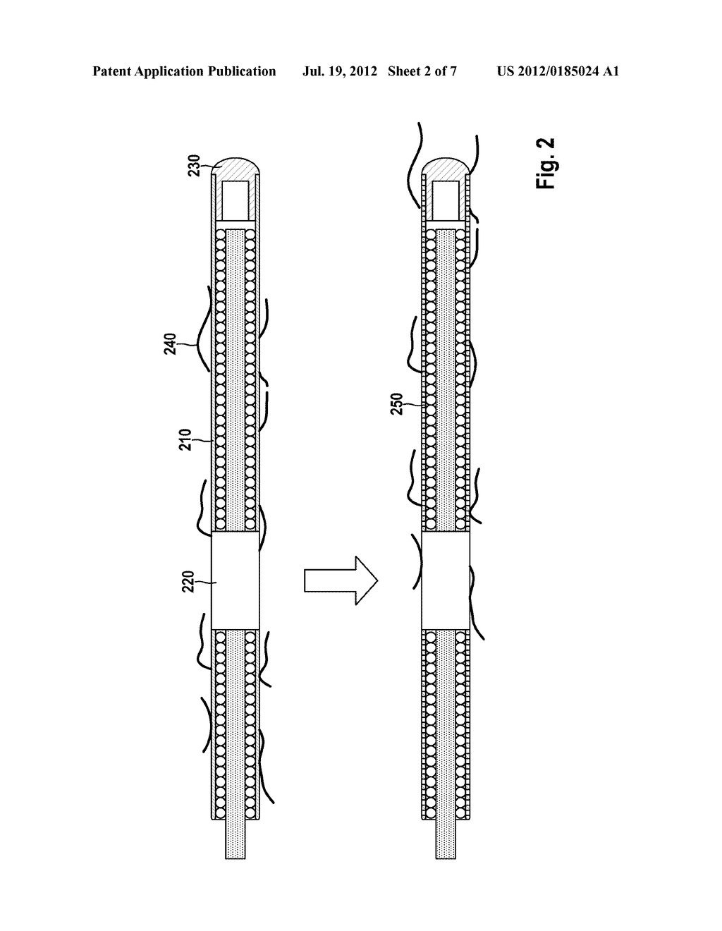 Self-Dissolving Electrode or Probe Implant - diagram, schematic, and image 03