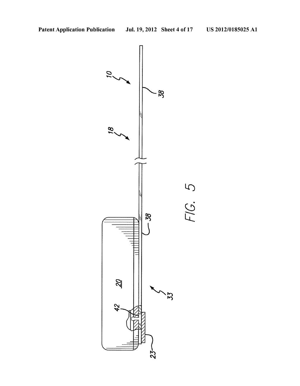 Electronics Package Suitable for Implantation - diagram, schematic, and image 05