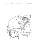 HYBRID COCHLEAR IMPLANT diagram and image