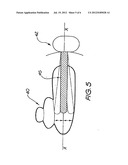 HYBRID COCHLEAR IMPLANT diagram and image