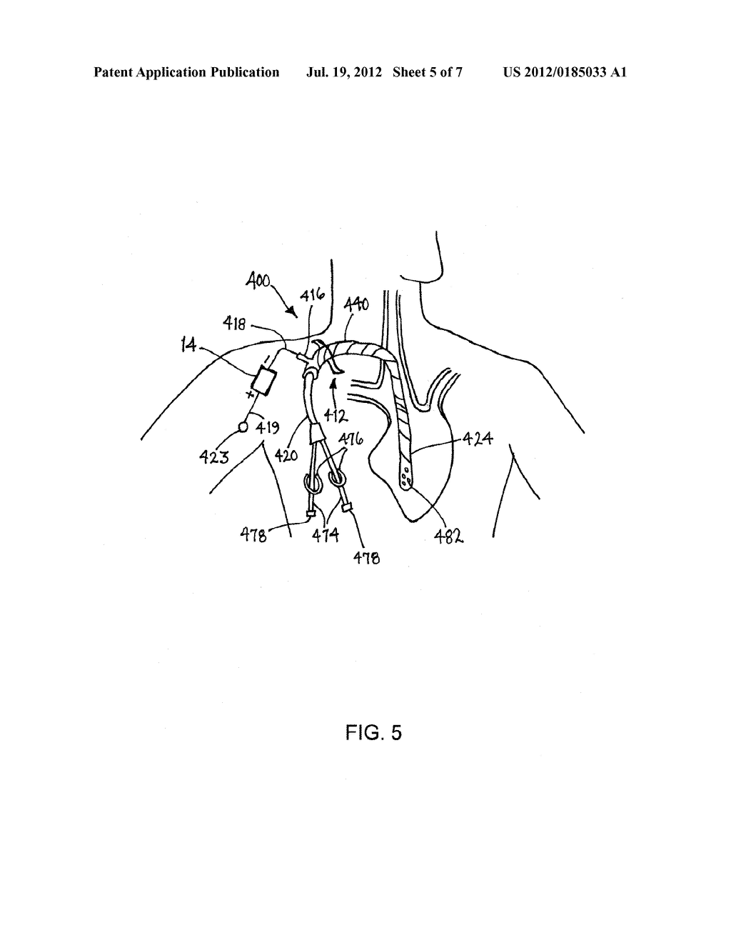 CHARGED GRAFTS AND METHODS FOR USING THEM - diagram, schematic, and image 06