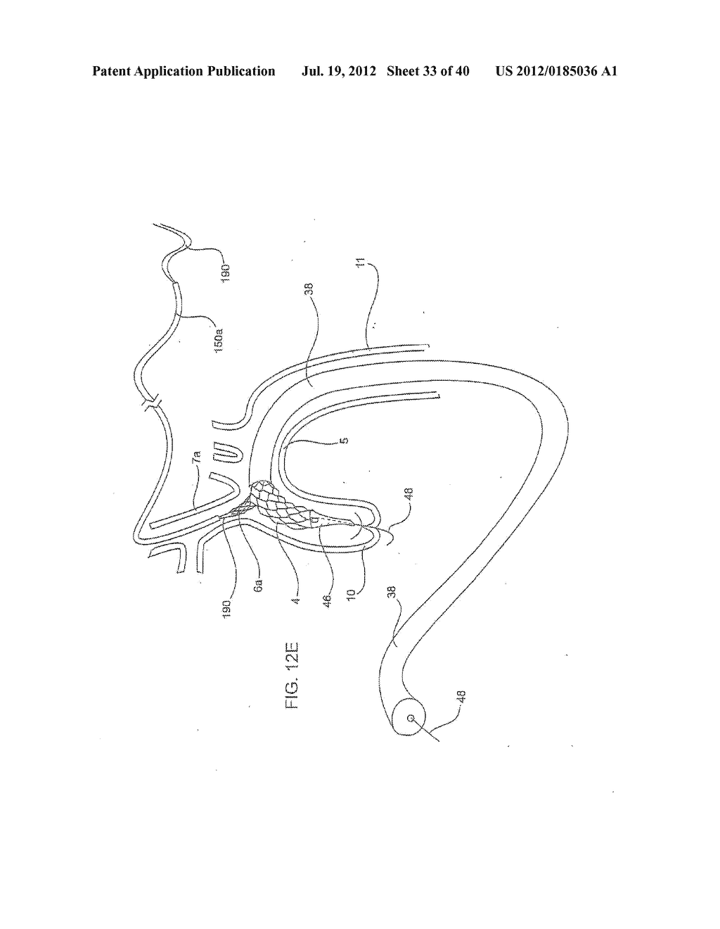 APPARATUS AND METHOD FOR DEPLOYING AN IMPLANTABLE DEVICE WITHIN THE BODY - diagram, schematic, and image 34