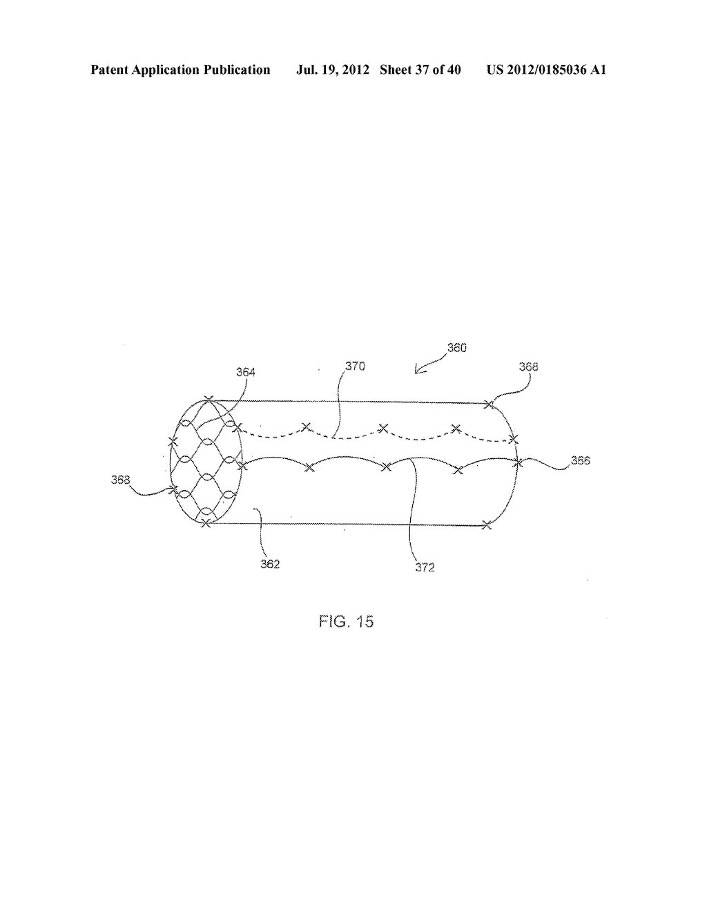 APPARATUS AND METHOD FOR DEPLOYING AN IMPLANTABLE DEVICE WITHIN THE BODY - diagram, schematic, and image 38