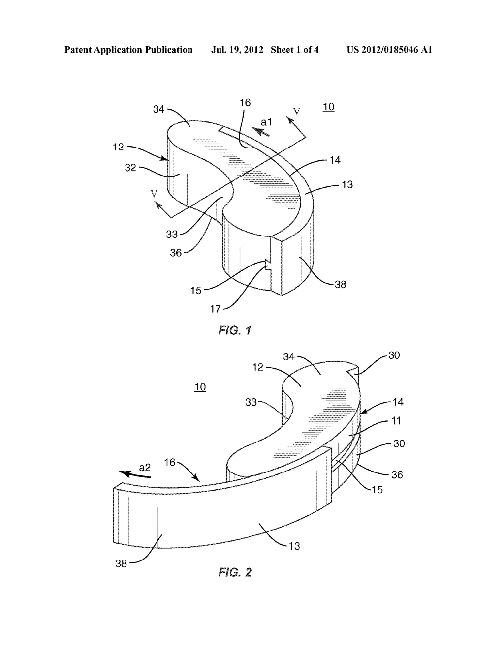 INTERBODY CONTAINMENT IMPLANT - diagram, schematic, and image 02