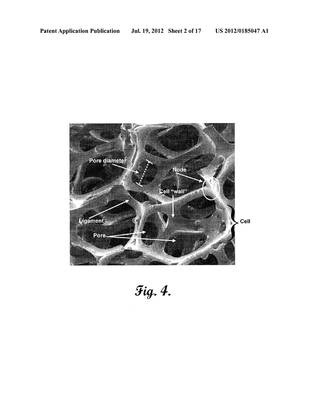 REINFORCED CARBON FIBER/CARBON FOAM INTERVERTEBRAL SPINE FUSION DEVICE - diagram, schematic, and image 03