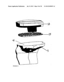 Spacer Apparatus and Method for Achieving Improved Fit and Balance in Knee     Joints diagram and image