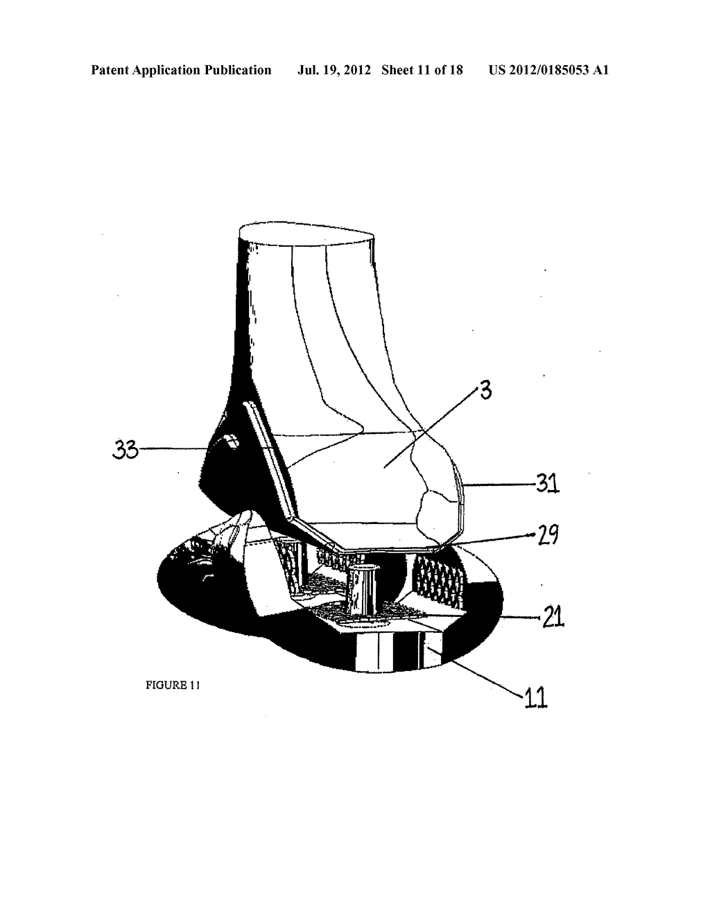 Spacer Apparatus and Method for Achieving Improved Fit and Balance in Knee     Joints - diagram, schematic, and image 12