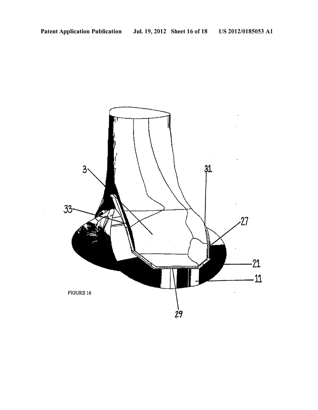 Spacer Apparatus and Method for Achieving Improved Fit and Balance in Knee     Joints - diagram, schematic, and image 17