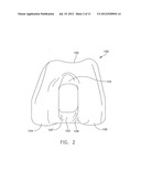 MEDIAL PIVOT POSTERIOR STABILIZED KNEE IMPLANT SYSTEM diagram and image