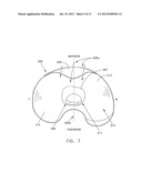 MEDIAL PIVOT POSTERIOR STABILIZED KNEE IMPLANT SYSTEM diagram and image