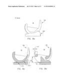 MEDIAL PIVOT POSTERIOR STABILIZED KNEE IMPLANT SYSTEM diagram and image