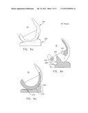 MEDIAL PIVOT POSTERIOR STABILIZED KNEE IMPLANT SYSTEM diagram and image