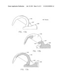 MEDIAL PIVOT POSTERIOR STABILIZED KNEE IMPLANT SYSTEM diagram and image