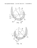 MEDIAL PIVOT POSTERIOR STABILIZED KNEE IMPLANT SYSTEM diagram and image