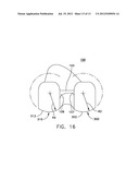 MEDIAL PIVOT POSTERIOR STABILIZED KNEE IMPLANT SYSTEM diagram and image