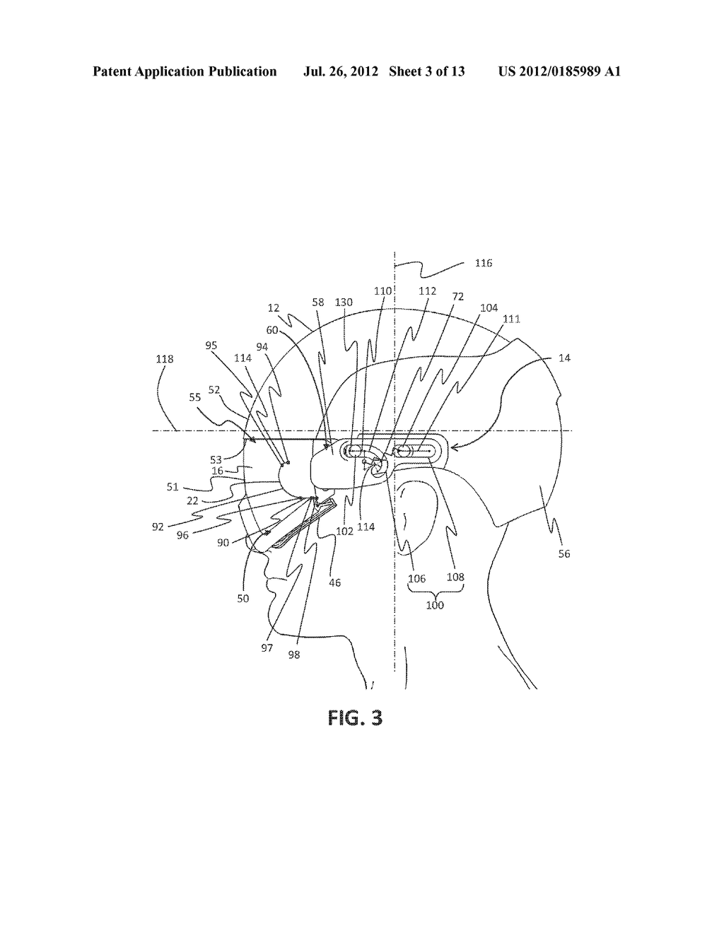 HELMET HAVING A GUIDING MECHANISM FOR A COMPATIBLE VISOR - diagram, schematic, and image 04