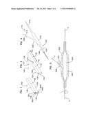 Joined Inflation Portions for Bifurcation Catheter diagram and image