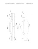 Joined Inflation Portions for Bifurcation Catheter diagram and image