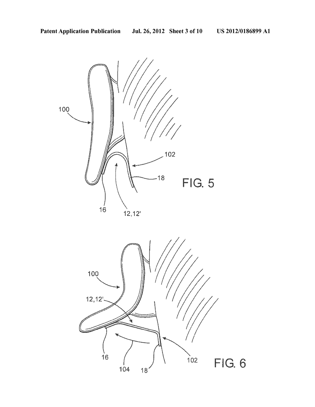 HEARING ASSISTANCE DEVICE - diagram, schematic, and image 04