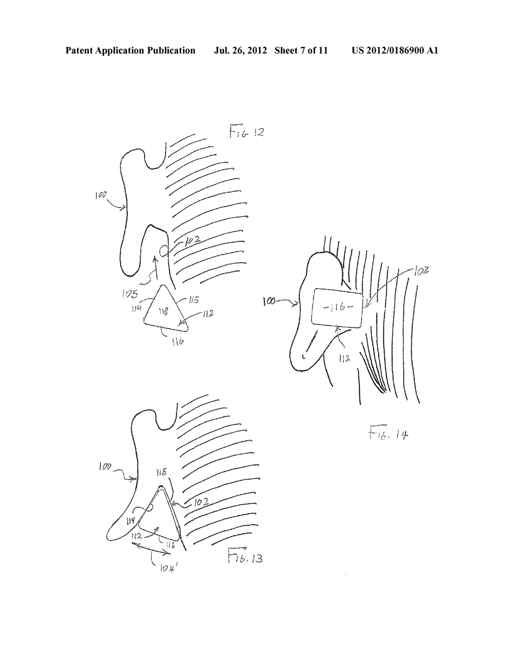 HEARING ASSISTANCE DEVICE - diagram, schematic, and image 08