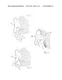 HEARING ASSISTANCE DEVICE diagram and image