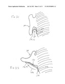 HEARING ASSISTANCE DEVICE diagram and image