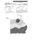 ENDOTRACHEAL TUBE CUFF PRESSURE MEASURING DEVICE diagram and image