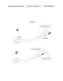 ENDOTRACHEAL TUBE CUFF PRESSURE MEASURING DEVICE diagram and image