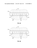 ADJUSTABLE SPAN RECORDING HEAD diagram and image